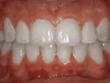 left-image