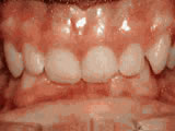 left-image