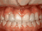 left-image