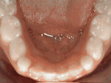 left-image