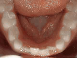 left-image