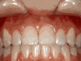 left-image