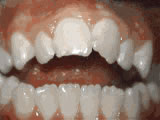 left-image