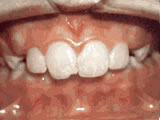 left-image
