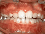 left-image