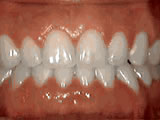left-image