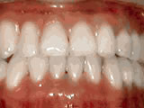 left-image