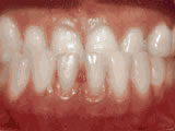 left-image